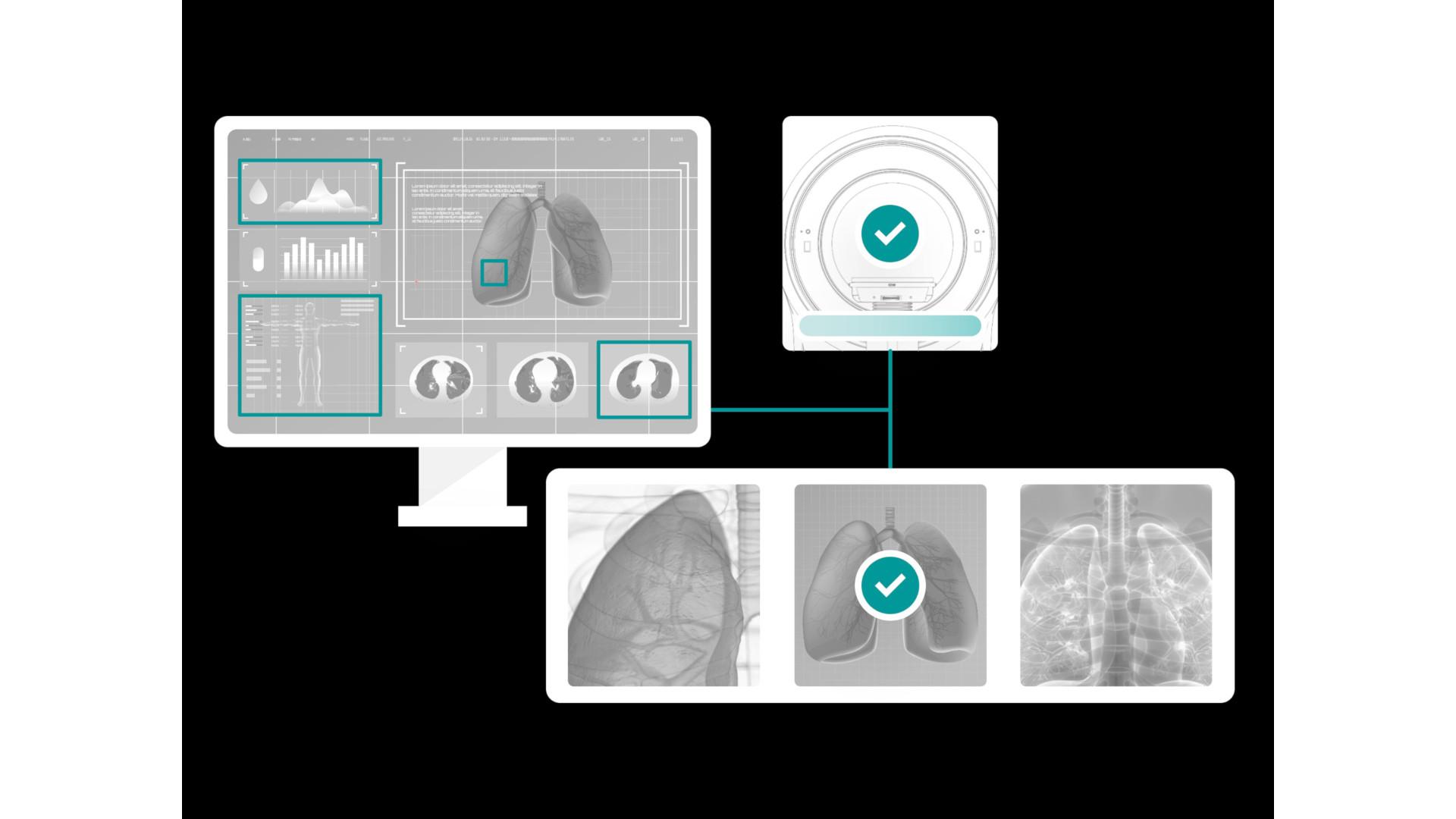 Smartly assisted and intelligent scanning for more time to care for patients