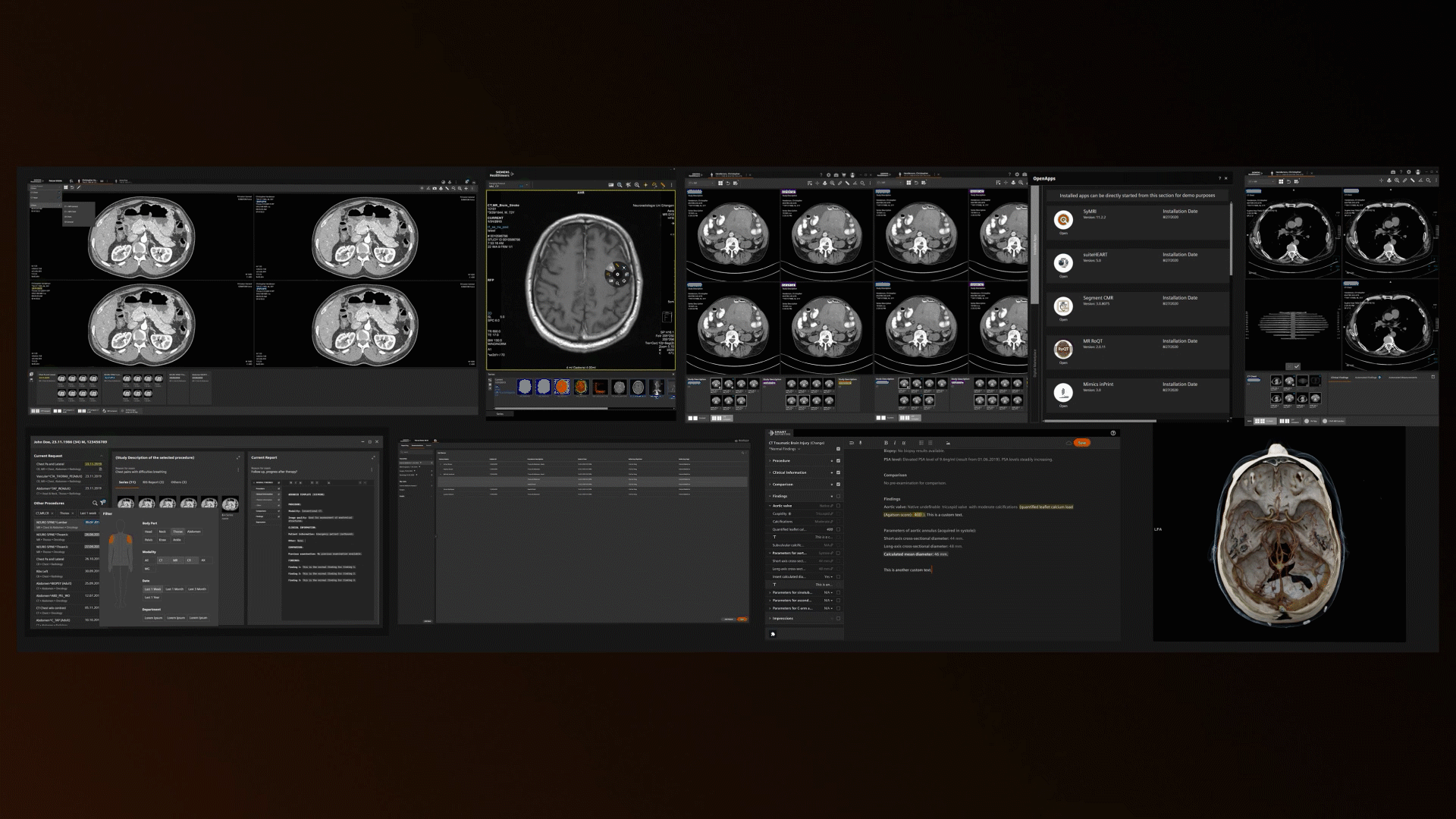 ECR 2026 - European Congress of Radiology in Vienna, Siemens Healthineers