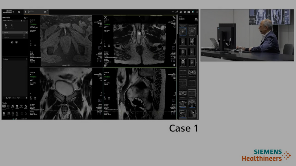A practical approach to Prostate Magnetic Resonance Imaging (MRI ...