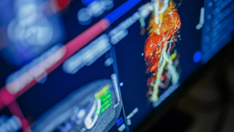 Unlock the potential of AI in healthcare Thumbnail