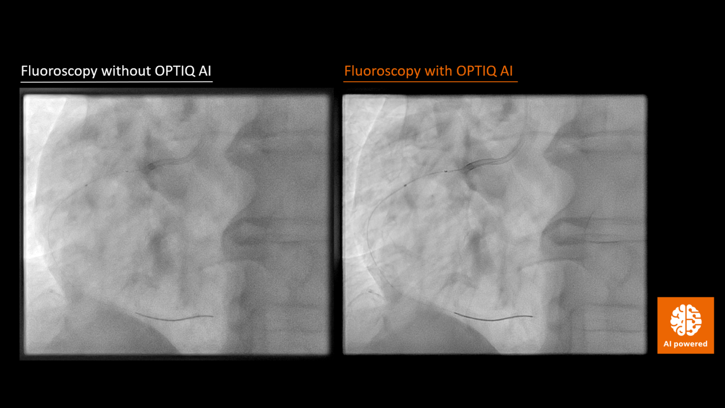 OPTIQ