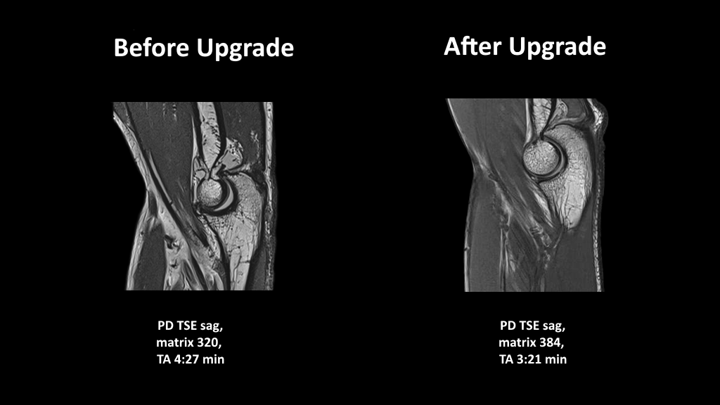 Fit Upgrade
