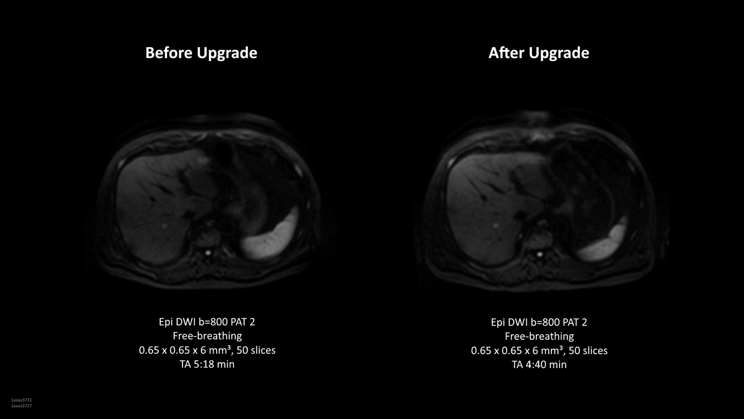 Fit Upgrade