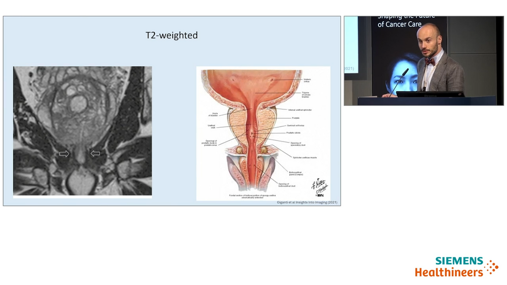Advancing Prostate MRI Reading and Interpretation with AI