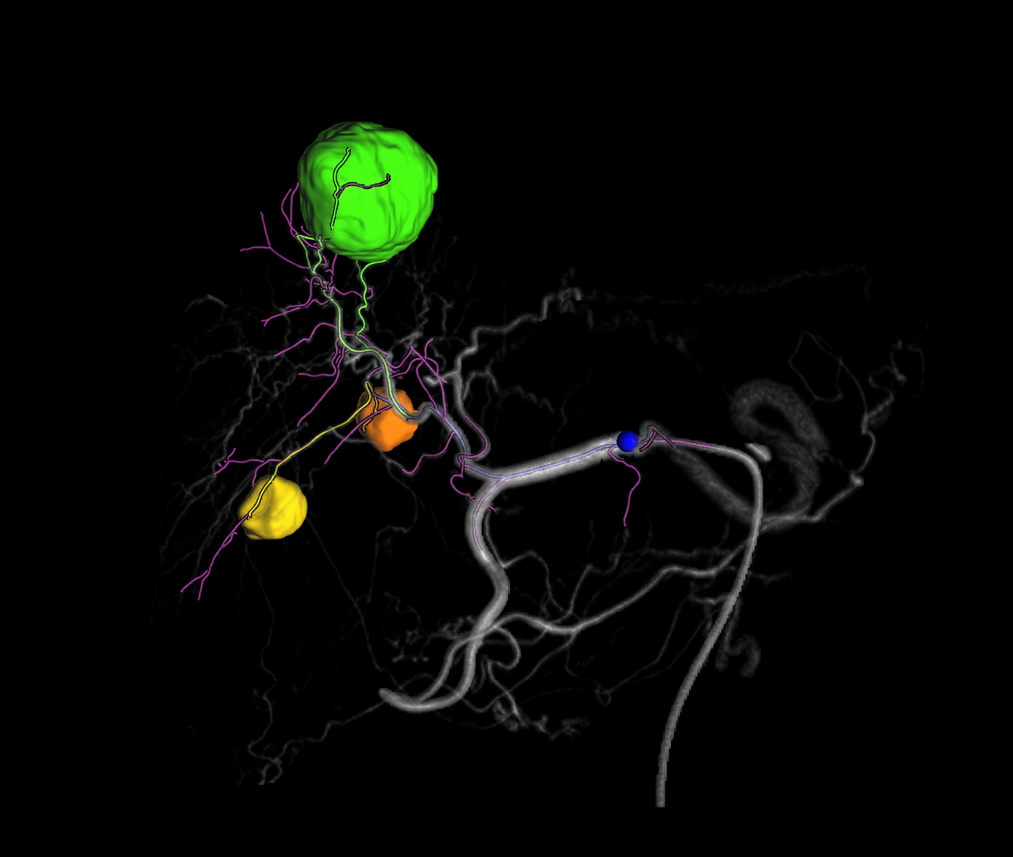myEmbolization Guide