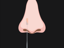 Feature 2: Nasal swab