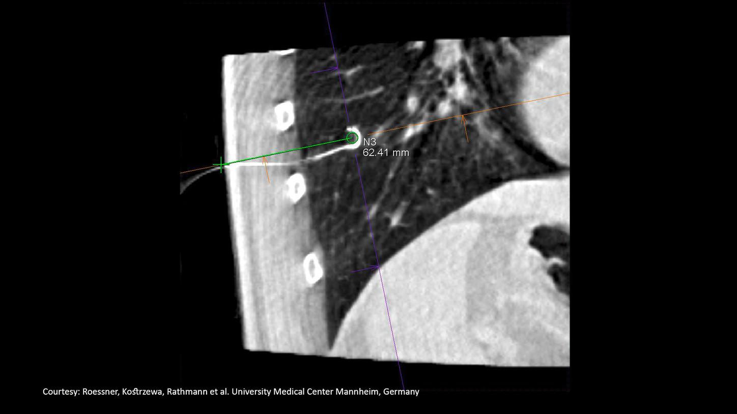 Thoracic Surgery