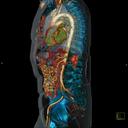 Thorax Abdomen CTA