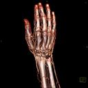 Wrist CTA