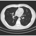 HR-Thorax