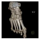Foot