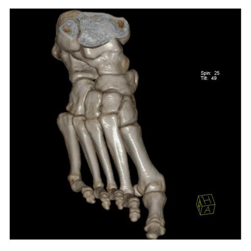 Foot