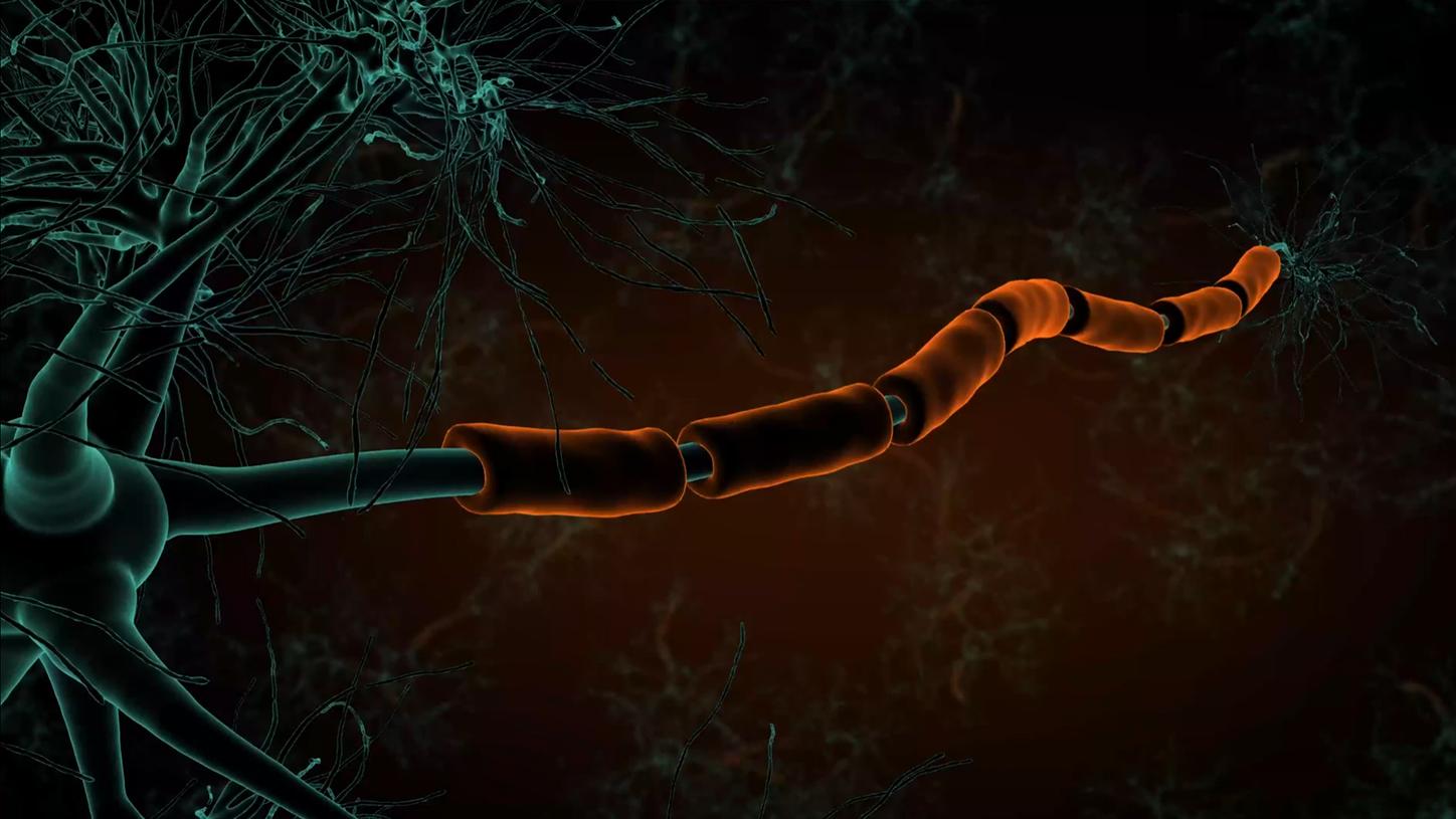 Siemens Healthineers NfL Neuron