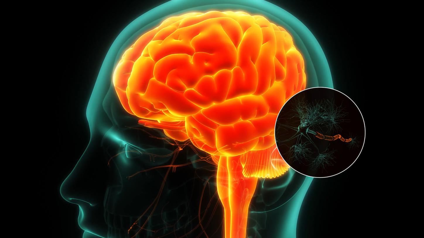 Siemens Healthineers NfL Brain