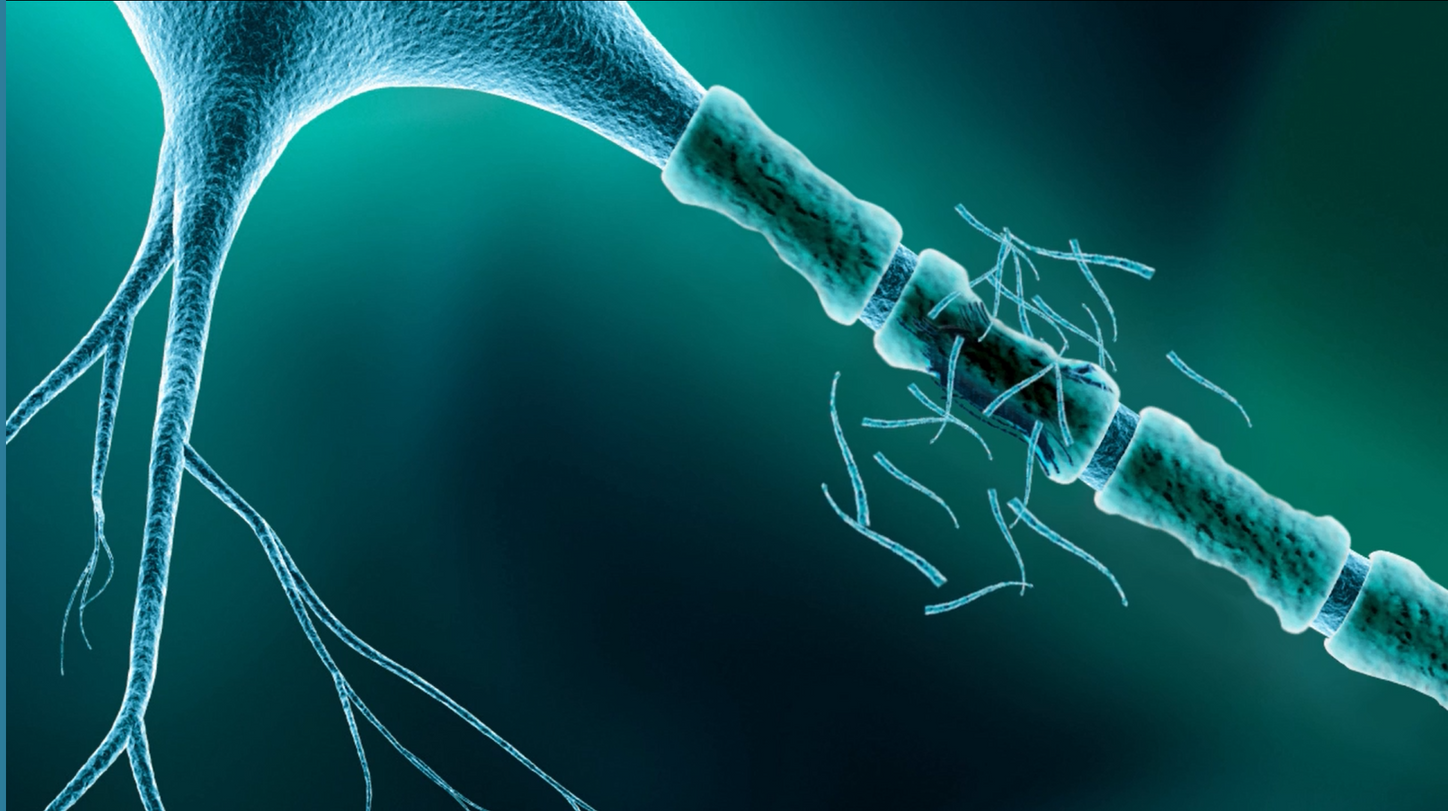 Interventional Neuroradiology and Neurosurgery