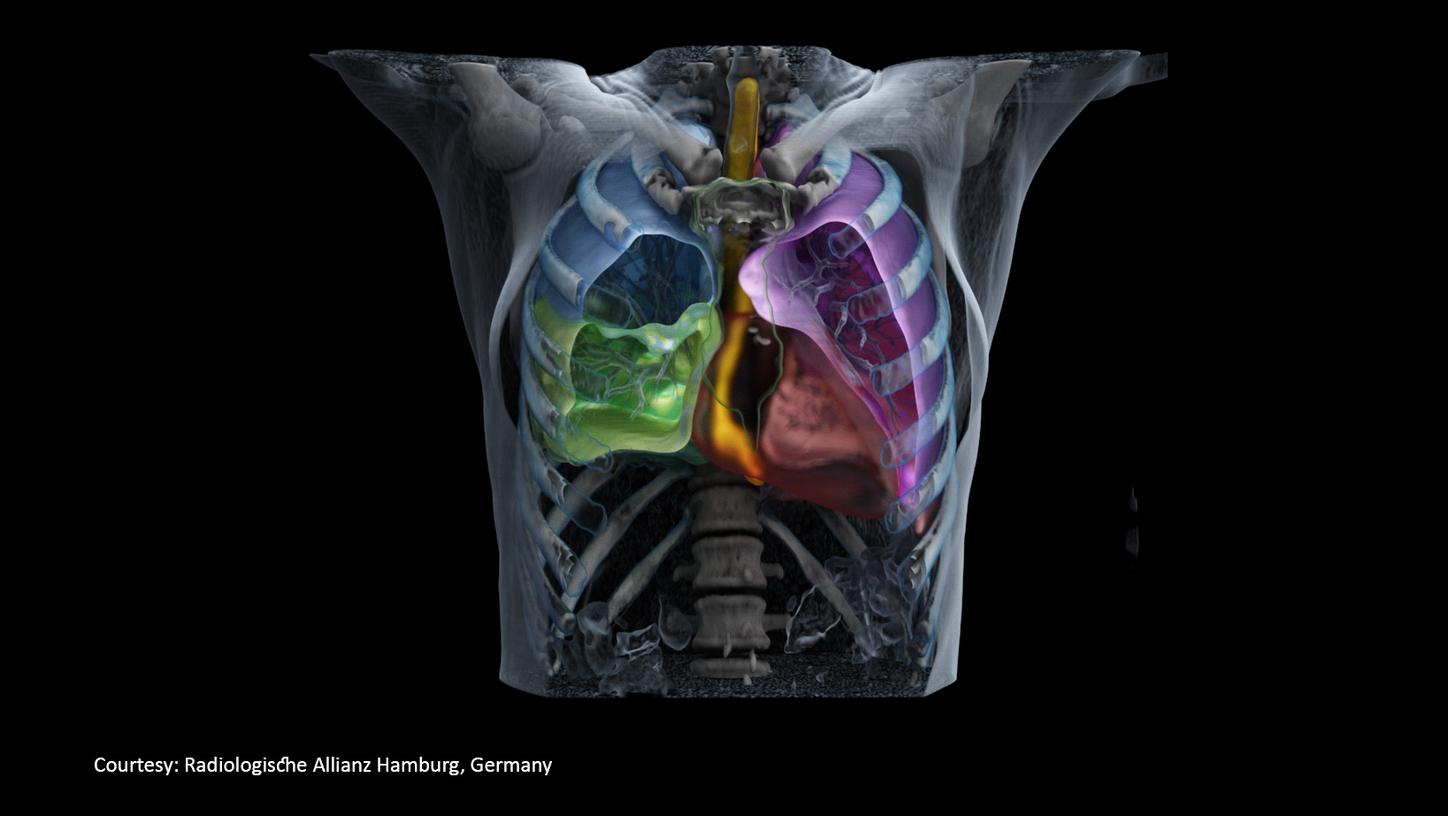 Imaging for radiotherapy planning in the lung