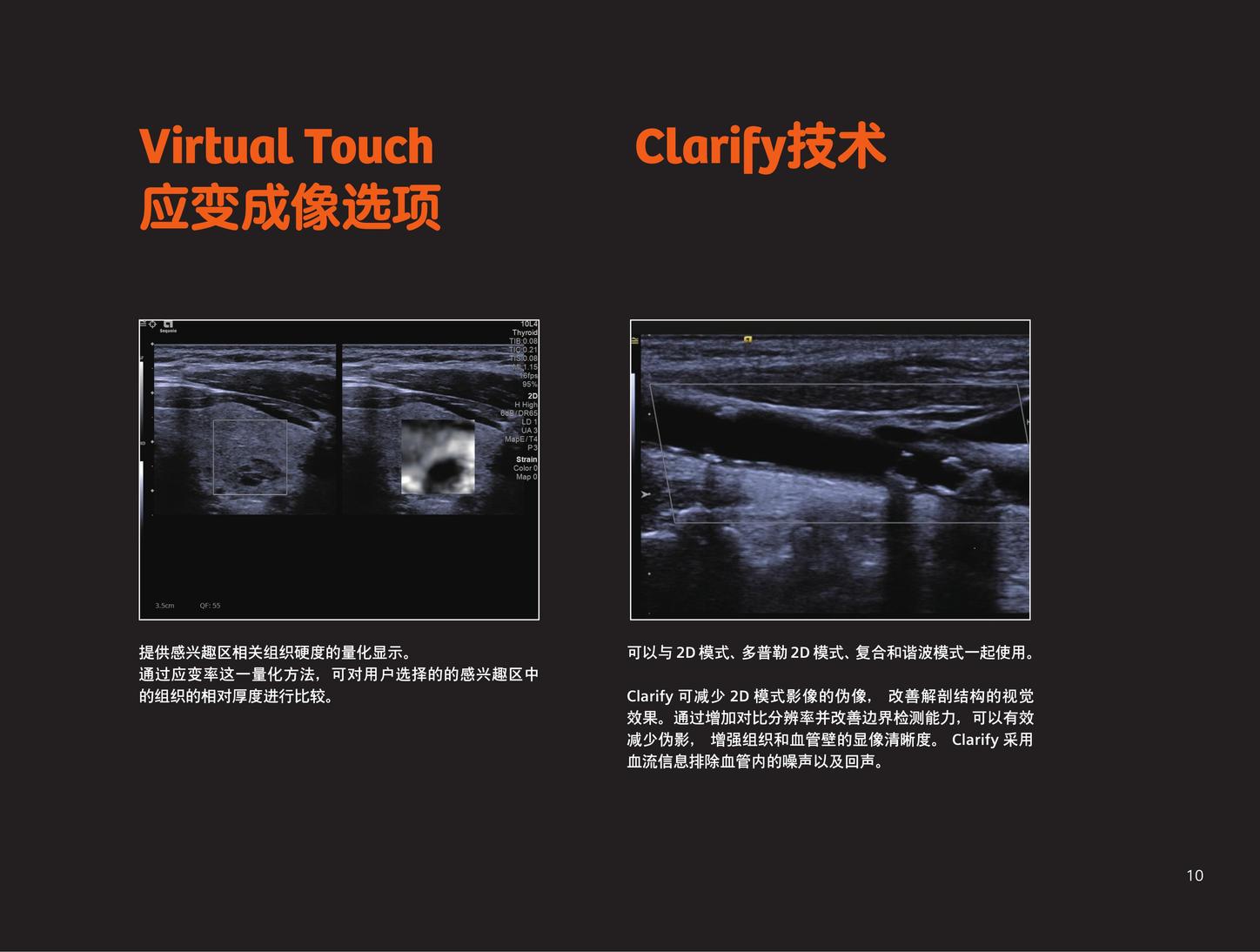 ACUSON Sequoia virtual touch